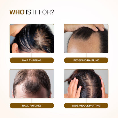 Advanced Hair Growth Serum Roll-On With 5% Rosemary, 4% Anagain, & 3% Redensyl - 25 ml