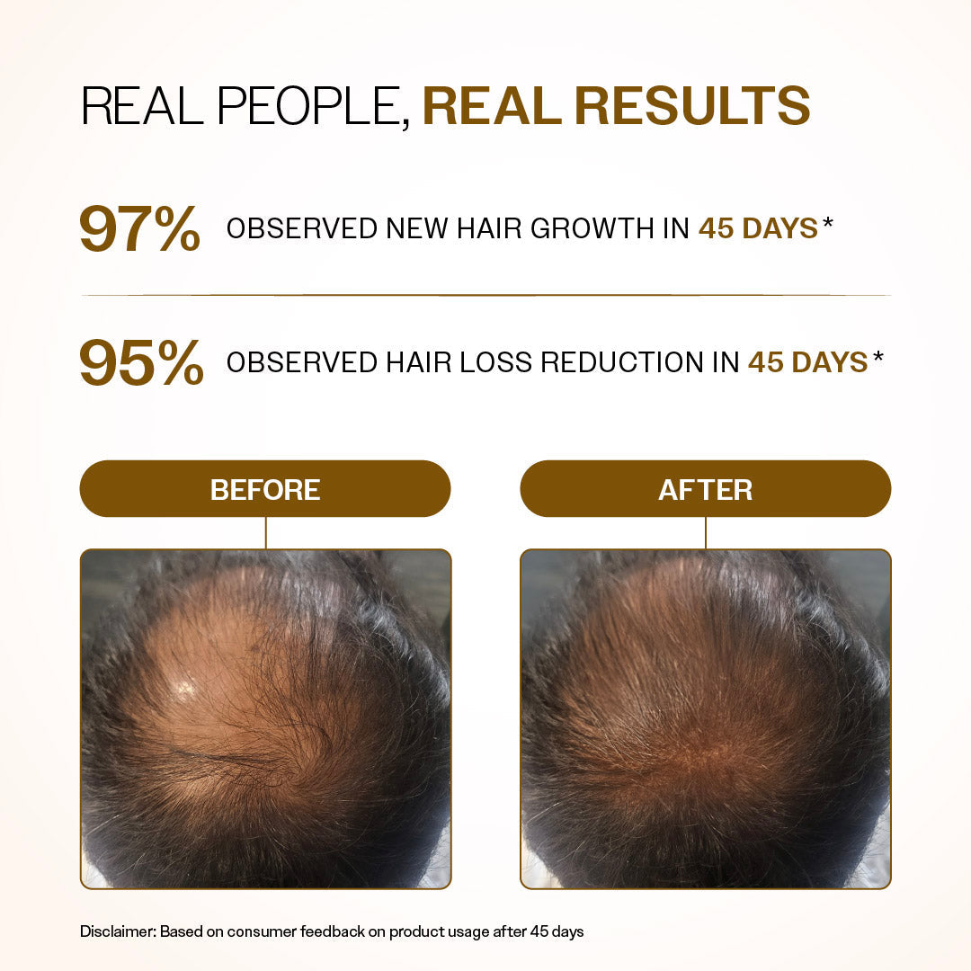 Advanced Hair Growth Serum Roll-On With 5% Rosemary, 4% Anagain, & 3% Redensyl - 25 ml